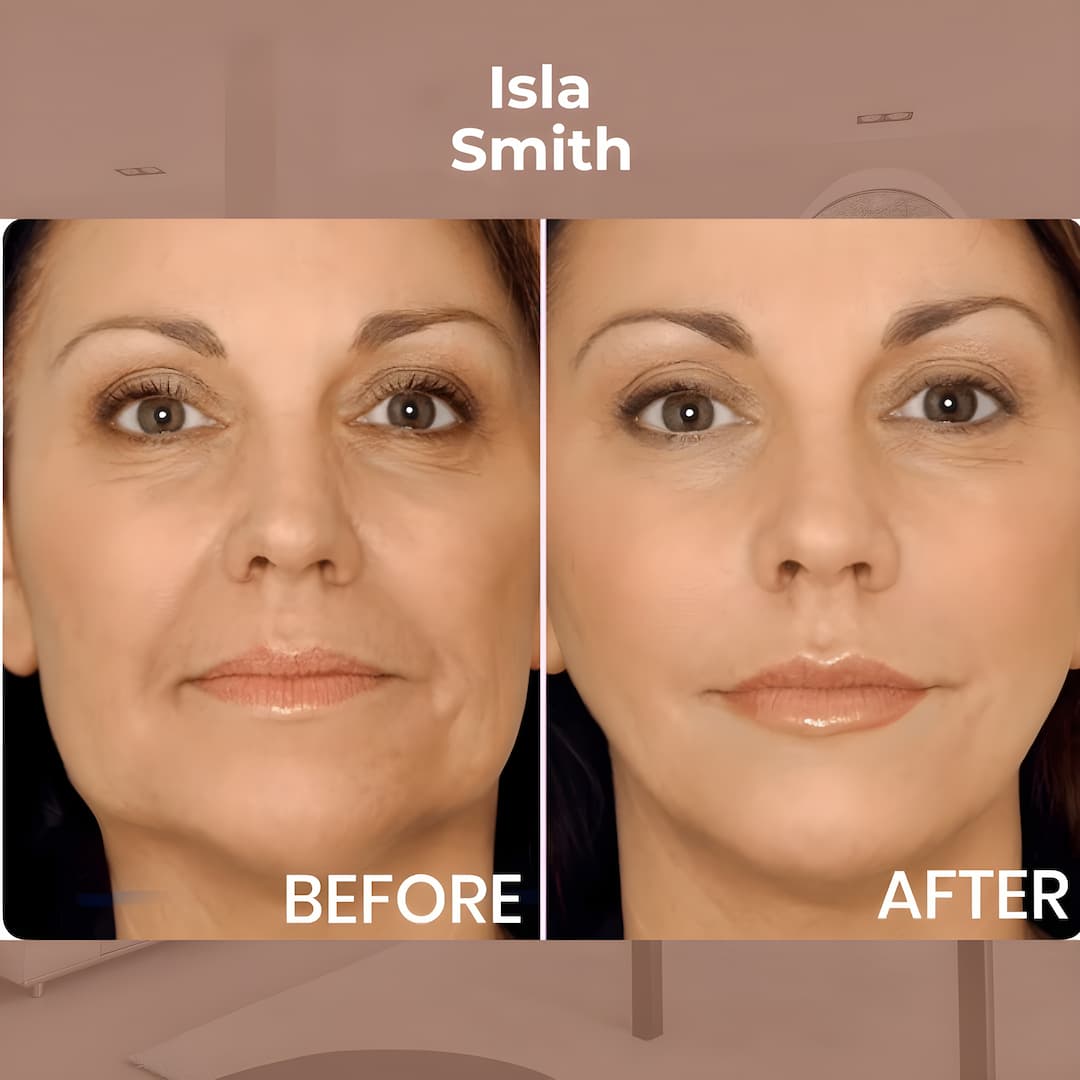 StraffPflaster™ Anti-Aging Kraft