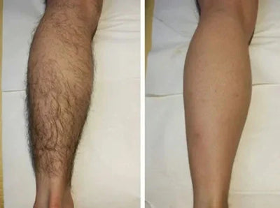 SanftHaut™ Lang anhaltendes geschmeidiges Selbstvertrauen