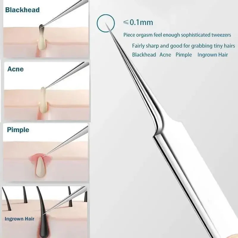 Avelena | 11Pcs Einwachs Haarpinzetten & Unreinheitenentfernungsnadel – Porenreinigungsakne & Schwarze Punkte Reiniger Tiefe Reinigende Hautpflege Werkzeuge