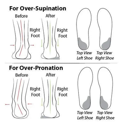 Bequeme Orthopädische Sommerschuhe mit Dämpfung – Tessa