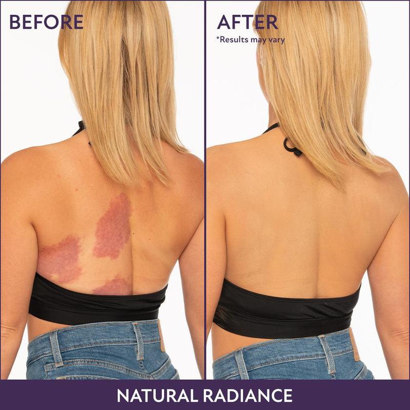 Jordyn | Body Coverage Perfector - Wasserdichte, leichte und makellose Körper-Make-up