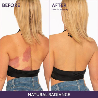 Jordyn | Body Coverage Perfector - Wasserdichte, leichte und makellose Körper-Make-up