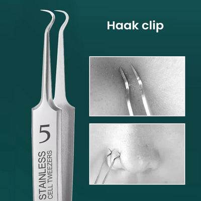 HautGreif™ Zielgerichtete Pickelentfernung