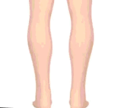 Talina – Orthopädische Sandalen